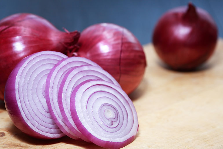 Onions: Acid Reflux? Here Are 10 Foods You Should Avoid