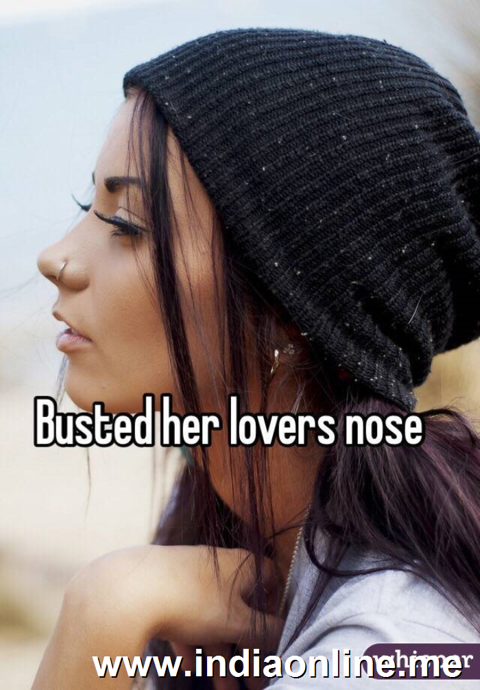 Busted her lovers nose