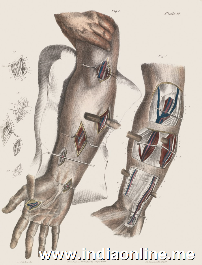 Sites for ligature of arteries in the lower arm and elbow joint.