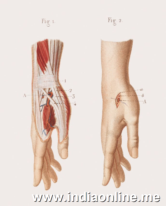 Musculature and blood supply of the wrist and hand.