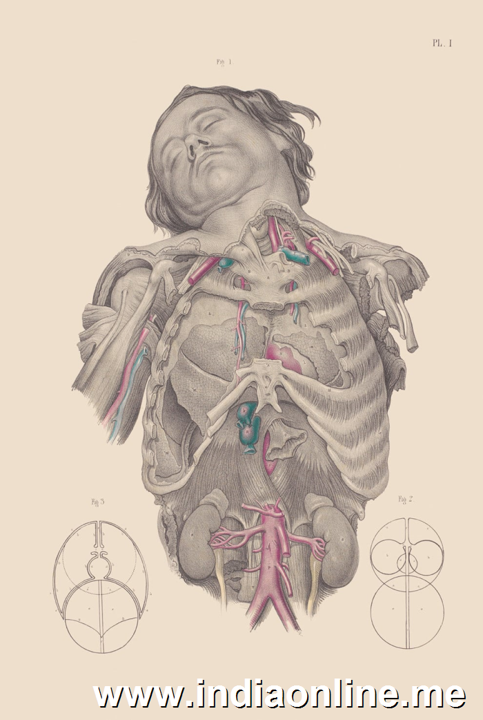 Dissection of the thorax